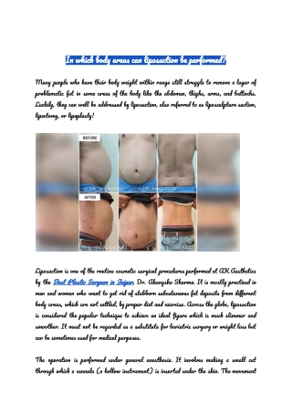 In which body areas can liposuction be performed?