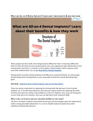 What are All-on-4 Dental Implants_ Learn about their benefits & how they work