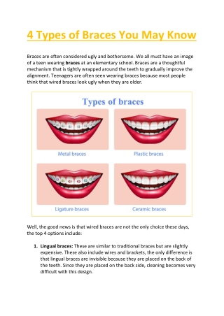 4 Types of Braces You May Know
