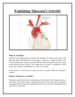 Explaining Takayasu's Arteritis