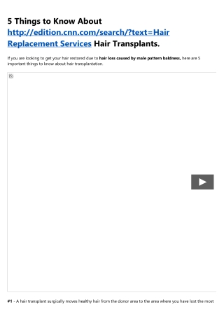 Hair Transplant Reviews