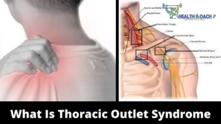 Stretching Exercises For Thoracic Outlet Syndrome Treatment