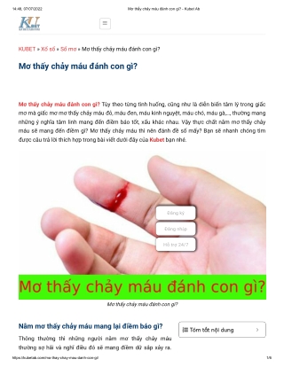 Mơ thấy chảy máu đánh con gì_ - Kubet Ab