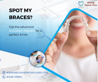 Invisalign Aligners Treatment | Best Dental Clinic in Bellandur, Bangalore