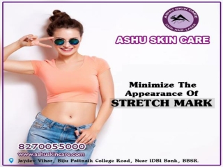 ashu skin care is best for stretch mark remove treatment clinic in bhubaneswar, odisha