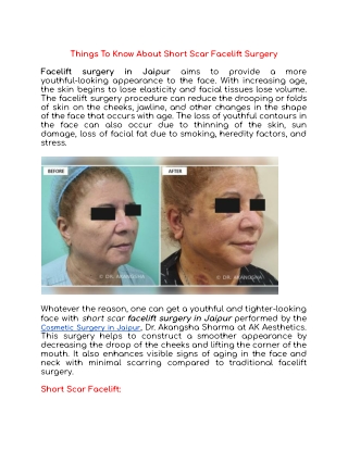 Things To Know About Short Scar Facelift Surgery
