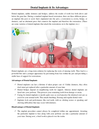 Dental Implants & Its Advantages