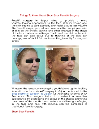 Things To Know About Short Scar Facelift Surgery