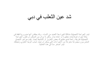 شد عين الثعلب في دبي