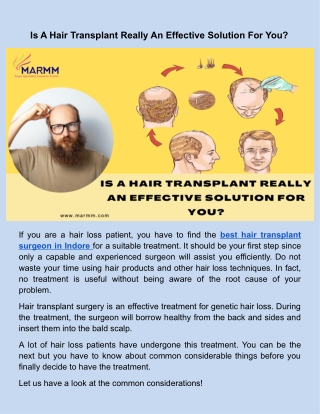 Is A Hair Transplant Really An Effective Solution For You_.docx