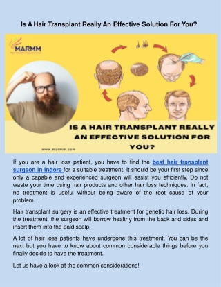 Is A Hair Transplant Really An Effective Solution For You_.docx