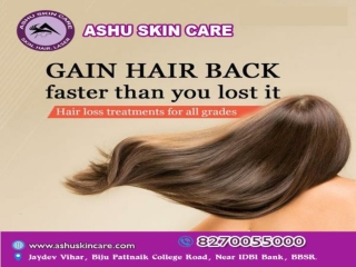 ashu skin care is best for hair loss treatment clinic in bhubaneswar, odisha