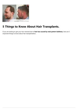 Hair Transplant Price