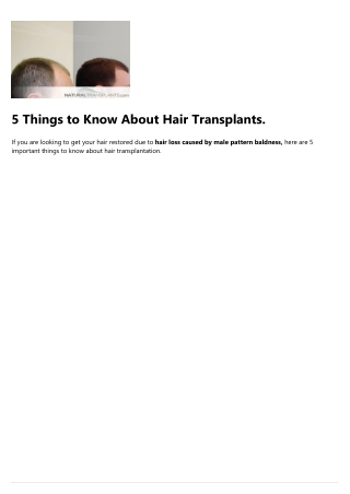Hair Restoration Price