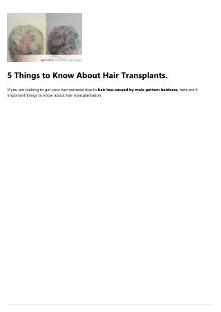 Hair Transplant Surgery