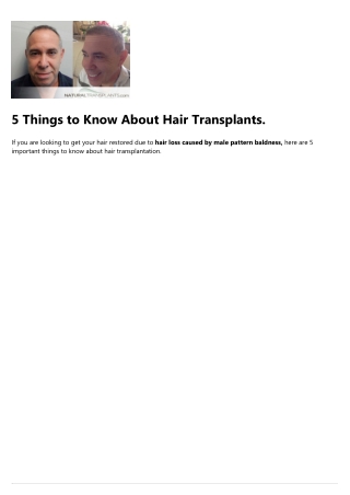Hair Restoration Prices
