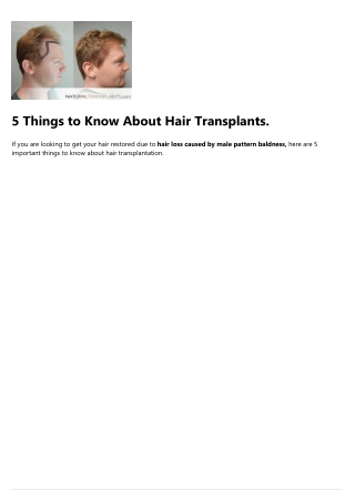 Hair Transplant Price