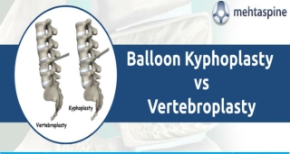 Kyphoplasty and Vertebroplasty