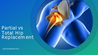 Partial Vs Total Hip Replacement