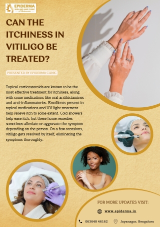 Can the itchiness in Vitiligo be treated | Best Skin Clinic in Jayanagar