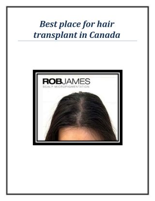 Best place for hair transplant in Canada
