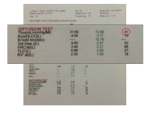 Pulmonary function tests Diffusion study Steps to diagnose ILD Part 3 Dr. Sheetu singh