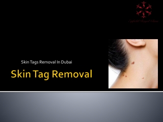 Skin Tag Removal in dubai