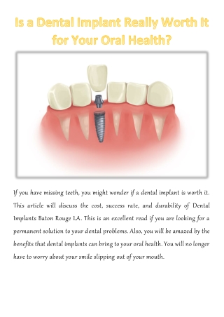 Is a Dental Implant Really Worth It for Your Oral Health