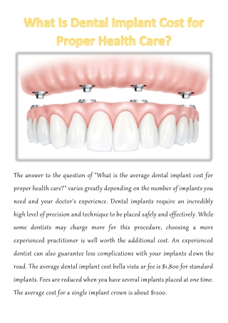What Is Dental Implant Cost for Proper Health Care