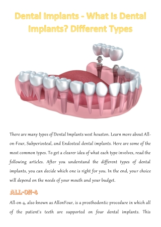 Dental Implants - What Is Dental Implants? Different Types