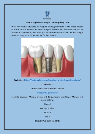 Dental Implants In Bhopal  Smile-gallery.com