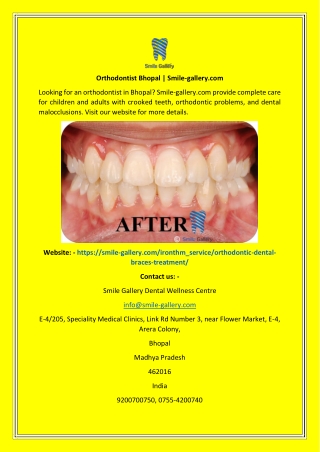 Orthodontist Bhopal  Smile-gallery.com