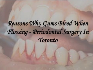 Reasons Why Gums Bleed When Flossing - Periodontal Surgery In Toronto