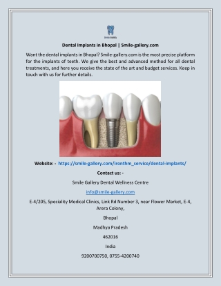 Dental Implants In Bhopal  Smile-gallery