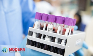 Blood Test Home Sample Collection in Kolkata