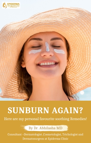 How to treat Sunburn Skin | Best Skin Clinics in Jayanagar | Epiderma Clinic