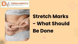 Stretch Marks - What Should Be Done