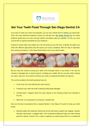 Get Your Teeth Fixed Through San Diego Dentist CA