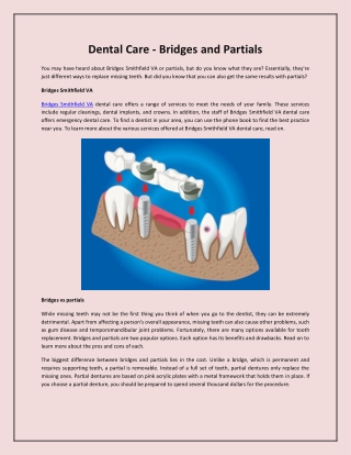 Dental Care - Bridges and Partials