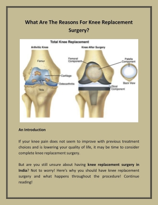 What Are The Reasons For Knee Replacement Surgery