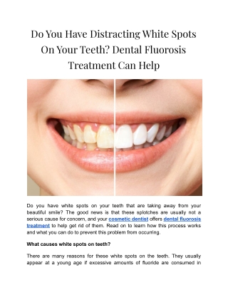Do You Have Distracting White Spots On Your Teeth (1)