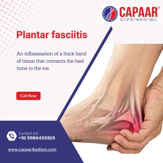 Physiotherapy for Plantar Fasciitis | Physiotherapy Centre in Hulimavu | CAPAAR
