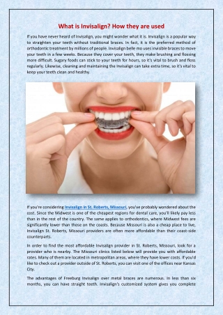 What is Invisalign? How they are used