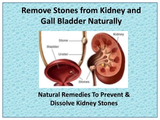 Dissolve and clear Kidney Stone with Stonil Capsule