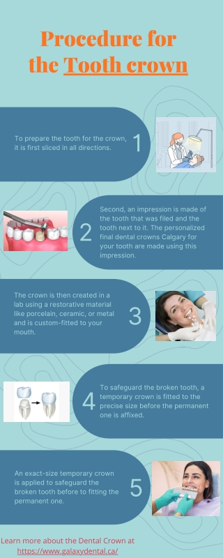 Tooth Crown Dental Calgary - Galaxy Dental