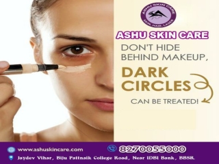 ashu skin care is best for under eye dark circle remove treatment clinic in bhubaneswar, odisha