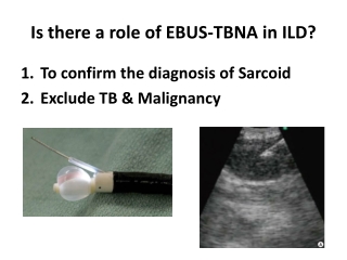 Is there a role of EBUS-TBNA in ILD Part 7 Dr. Sheetu singh