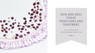 Skin and Soft Tissue Infections and Treatment