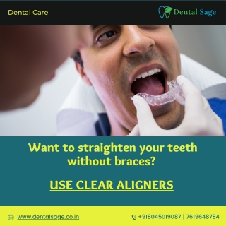 Use Clear Aligners| Best Dental Clinic in Yelahanka | Dental Sage