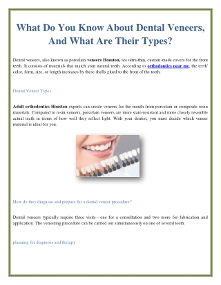 What Do You Know About Dental Veneers, And What Are Their Types?